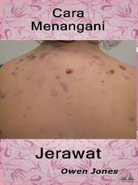 Cover Cara Menangani Jerawat