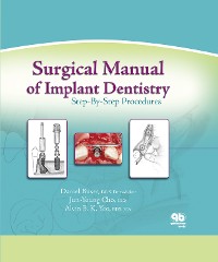 Cover Surgical Manual of Implant Dentistry