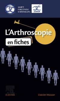 Cover L''Arthroscopie en fiches