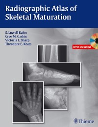 Cover Radiographic Atlas of Skeletal Maturation