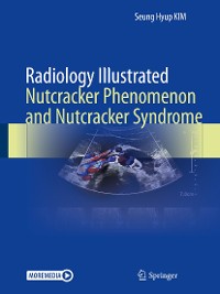 Cover Radiology Illustrated: Nutcracker Phenomenon and Nutcracker Syndrome