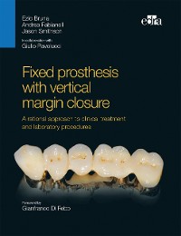 Cover Fixed prosthesis with vertical margin closure