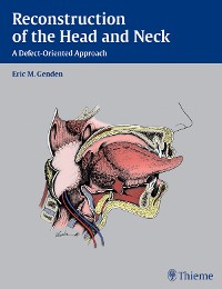 Cover Reconstruction of the Head and Neck