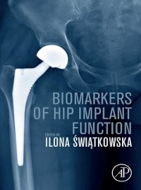 Cover Biomarkers of Hip Implant Function