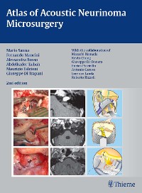 Cover Atlas of Acoustic Neurinoma Microsurgery