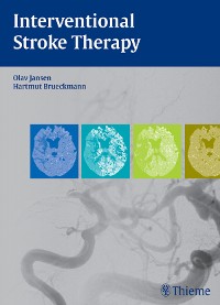 Cover Interventional Stroke Therapy