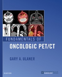 Cover Fundamentals of Oncologic PET/CT