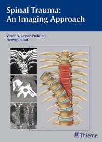 Cover Spinal Trauma - An Imaging Approach