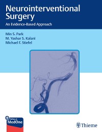 Cover Neurointerventional Surgery