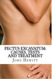 Cover Pectus Excavatum: Causes, Tests and Treatment