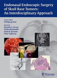 Cover Endonasal Endoscopic Surgery of Skull Base Tumors: An Interdisciplinary Approach