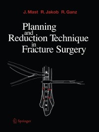 Cover Planning and Reduction Technique in Fracture Surgery