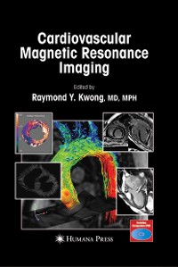 Cover Cardiovascular Magnetic Resonance Imaging