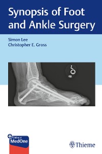 Cover Synopsis of Foot and Ankle Surgery