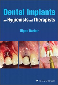 Cover Dental Implants for Hygienists and Therapists