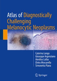 Cover Atlas of Diagnostically Challenging Melanocytic Neoplasms