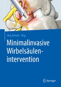 Cover Minimalinvasive Wirbelsäulenintervention