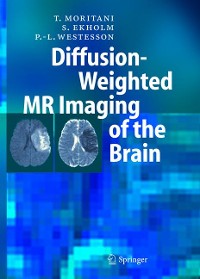 Cover Diffusion-Weighted MR Imaging of the Brain