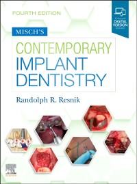 Cover Misch's Contemporary Implant Dentistry E-Book