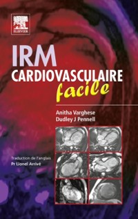 Cover IRM cardiovasculaire facile