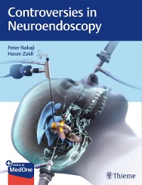 Cover Controversies in Neuroendoscopy