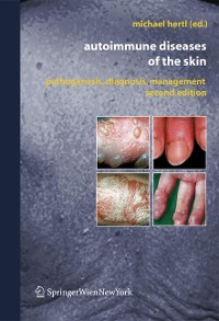 Cover Autoimmune Diseases of the Skin