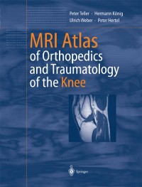 Cover MRI Atlas of Orthopedics and Traumatology of the Knee