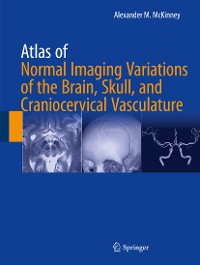 Cover Atlas of Normal Imaging Variations of the Brain, Skull, and Craniocervical Vasculature