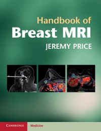 Cover Handbook of Breast MRI