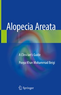 Cover Alopecia Areata