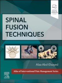 Cover Spinal Fusion Techniques - E-Book