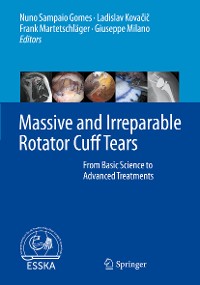 Cover Massive and Irreparable Rotator Cuff Tears