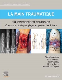 Cover La main traumatique 10 interventions courantes