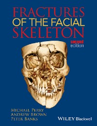 Cover Fractures of the Facial Skeleton