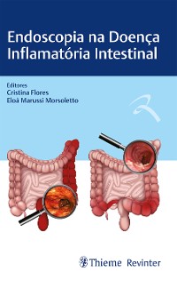 Cover Endoscopia na Doença Inflamatória Intestinal