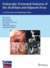 Cover Endoscopic Transnasal Anatomy of the Skull Base and Adjacent Areas