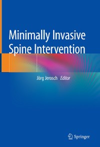 Cover Minimally Invasive Spine Intervention