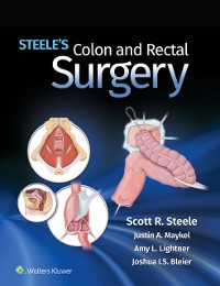 Cover Steele's Colon and Rectal Surgery