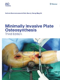 Cover Minimally Invasive Plate Osteosynthesis