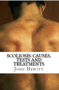 Cover Scoliosis: Causes, Tests and Treatments