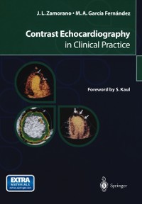 Cover Contrast Echocardiography in Clinical Practice