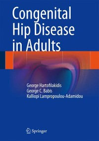 Cover Congenital Hip Disease in Adults