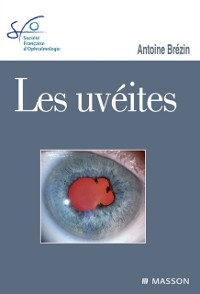 Cover Les uvéites