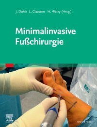 Cover Minimalinvasive Fuchirurgie