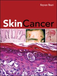 Cover Skin Cancer