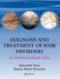 Cover Diagnosis and Treatment of Hair Disorders