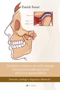 Cover Distúrbios internos da articulação temporomandibular para clínicos e especialistas