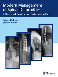 Cover Modern Management of Spinal Deformities