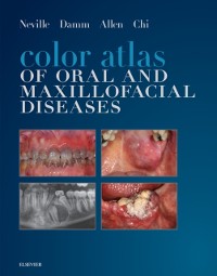 Cover Color Atlas of Oral and Maxillofacial Diseases - E-Book