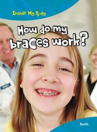 Cover How do my Braces Work?
